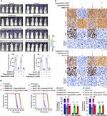 ZDHHC9 Antibody in Immunohistochemistry (IHC)