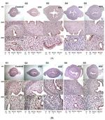 Progesterone Receptor Antibody in Immunohistochemistry (IHC)