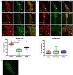 Estrogen Receptor alpha Antibody in Immunohistochemistry (IHC)