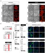 LOR Antibody in Immunocytochemistry (ICC/IF)