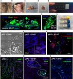 CD31 Antibody in Immunohistochemistry (IHC)