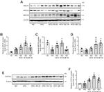 CYP7A1 Antibody in Western Blot (WB)