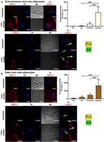 CXCL1 Antibody in Immunocytochemistry (ICC/IF)