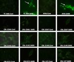 SARS/SARS-CoV-2 Nucleocapsid Antibody in Immunocytochemistry (ICC/IF)