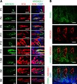 EGR2 Antibody in Immunohistochemistry (IHC)