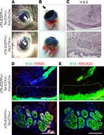 EGR2 Antibody in Immunohistochemistry (IHC)