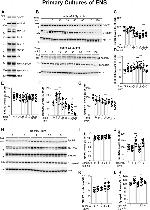 EphB2 Antibody in Western Blot (WB)