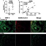SARS/SARS-CoV-2 Nucleocapsid Antibody in Immunohistochemistry, Immunohistochemistry (Paraffin) (IHC, IHC (P))