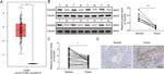 VSNL1 Antibody in Western Blot, Immunohistochemistry (WB, IHC)