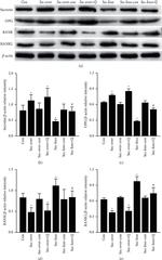 Secretin Antibody in Western Blot (WB)