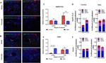 GFAP Antibody in Immunohistochemistry (IHC)