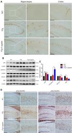 Phospho-Tau (Ser262) Antibody in Immunohistochemistry (IHC)