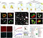 NF-H Antibody in Immunohistochemistry (IHC)