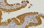 HMGCR Antibody in Immunohistochemistry (IHC)