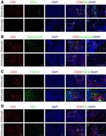 TGF beta-1 Antibody in Immunohistochemistry (IHC)