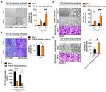 TGF beta-1,2,3 Antibody in Neutralization (Neu)