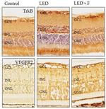 VEGF Receptor 2 Antibody in Immunohistochemistry (IHC)