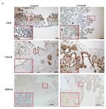 VEGF Antibody in Immunohistochemistry (IHC)