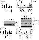 Acetyl-NFkB p65 (Lys310) Antibody in Western Blot (WB)