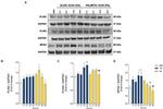 ADFP Antibody in Western Blot (WB)