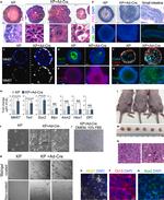 Villin Antibody in Immunocytochemistry (ICC/IF)