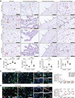 CD74 Antibody in Immunohistochemistry (IHC)