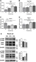 Phospho-TrkB (Tyr705) Antibody in Western Blot (WB)