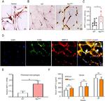 MMP12 Antibody in Immunohistochemistry (IHC)