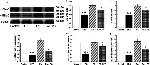 alpha-ENaC Antibody in Western Blot (WB)