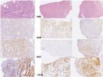 VDR Antibody in Immunohistochemistry (IHC)