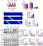 Phospholamban Antibody in Western Blot (WB)