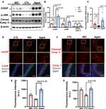 CHOP Antibody in Immunohistochemistry (IHC)