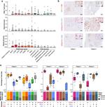 Granzyme B Antibody in Immunohistochemistry (IHC)