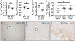 Claudin 2 Antibody in Immunohistochemistry (IHC)