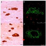 CD230 (PrP) Antibody in Immunohistochemistry (IHC)