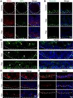 beta Catenin Antibody in Immunohistochemistry (IHC)