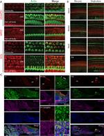 MUPP1 Antibody in Immunohistochemistry (IHC)