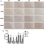 HTR1A Antibody in Immunohistochemistry (IHC)