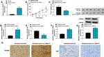 TGFBR2 Antibody in Immunohistochemistry (IHC)