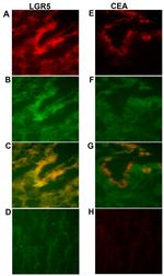 LGR5 Antibody in Immunohistochemistry (IHC)