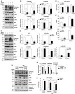 O-linked N-acetylglucosamine (O-GlcNAc) Antibody in Western Blot (WB)