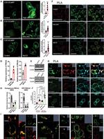 PMCA2 ATPase Antibody in Western Blot, Immunocytochemistry (WB, ICC/IF)