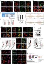 PMCA2 ATPase Antibody in Immunocytochemistry (ICC/IF)