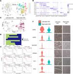 MUC5AC Antibody in Immunohistochemistry (IHC)