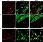 Vimentin Antibody in Immunohistochemistry (IHC)