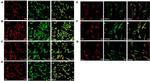 Vimentin Antibody in Immunohistochemistry (IHC)