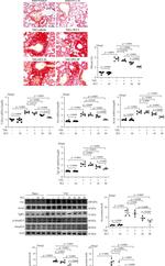 Fibronectin Antibody in Western Blot (WB)