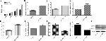 ADAMTS5 Antibody in Western Blot (WB)