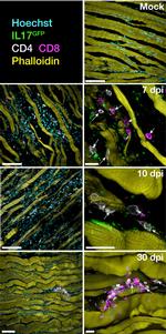 IL-17 A/F Antibody in Immunohistochemistry (IHC)