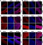 CXCL2 Antibody in Immunohistochemistry (IHC)